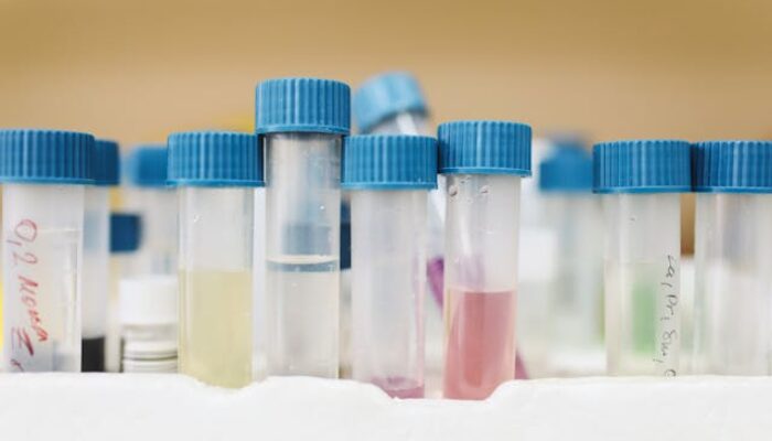 Mengenal Kemofobia: Ketakutan Berlebihan akan Bahan Kimia