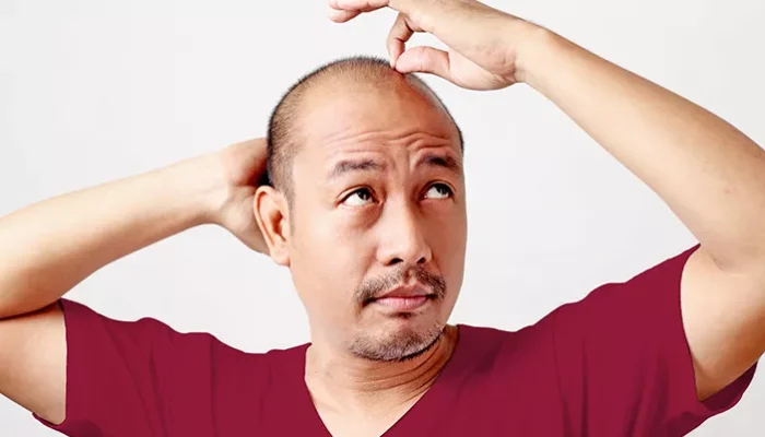 Bisa Bantu Kaum Pria Atasi Kebotakan, Aplikasi AI Ini Laris Manis