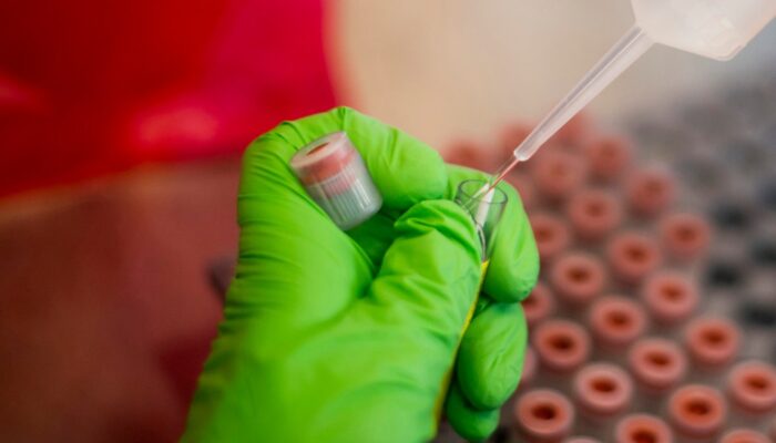 62 Kasus Super Flu Terdeteksi di Delapan Provinsi Indonesia